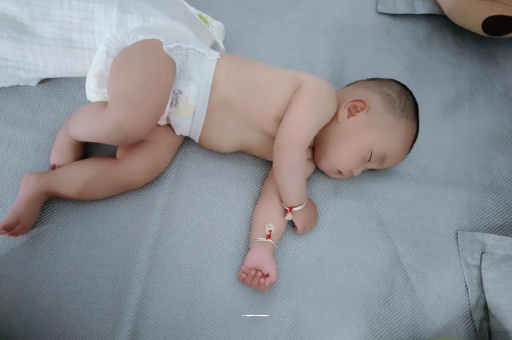 达州宝宝头上长痱子